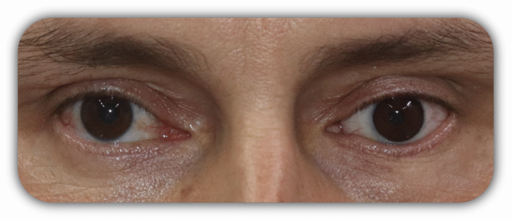 testimonios proteos oculares 6 testimonios proteos oculares 2