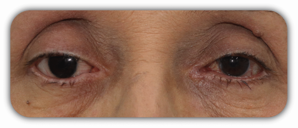 testimonios proteos oculares 007 testimonios proteos oculares 007